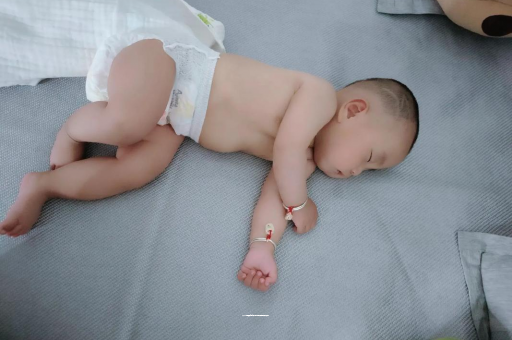 大连六个月宝宝眼睛散光